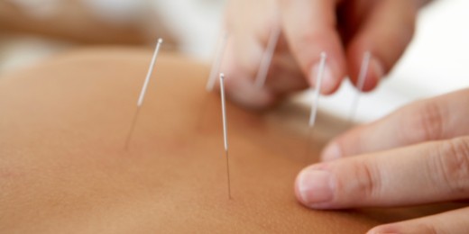 Maux de tête, stress, reflux, problèmes de peau, réveils nocturnes… pourraient être soignés par des aiguilles d’acupuncteur