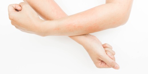 La peau de certains enfants est sujette à des réactions parfois impressionnantes